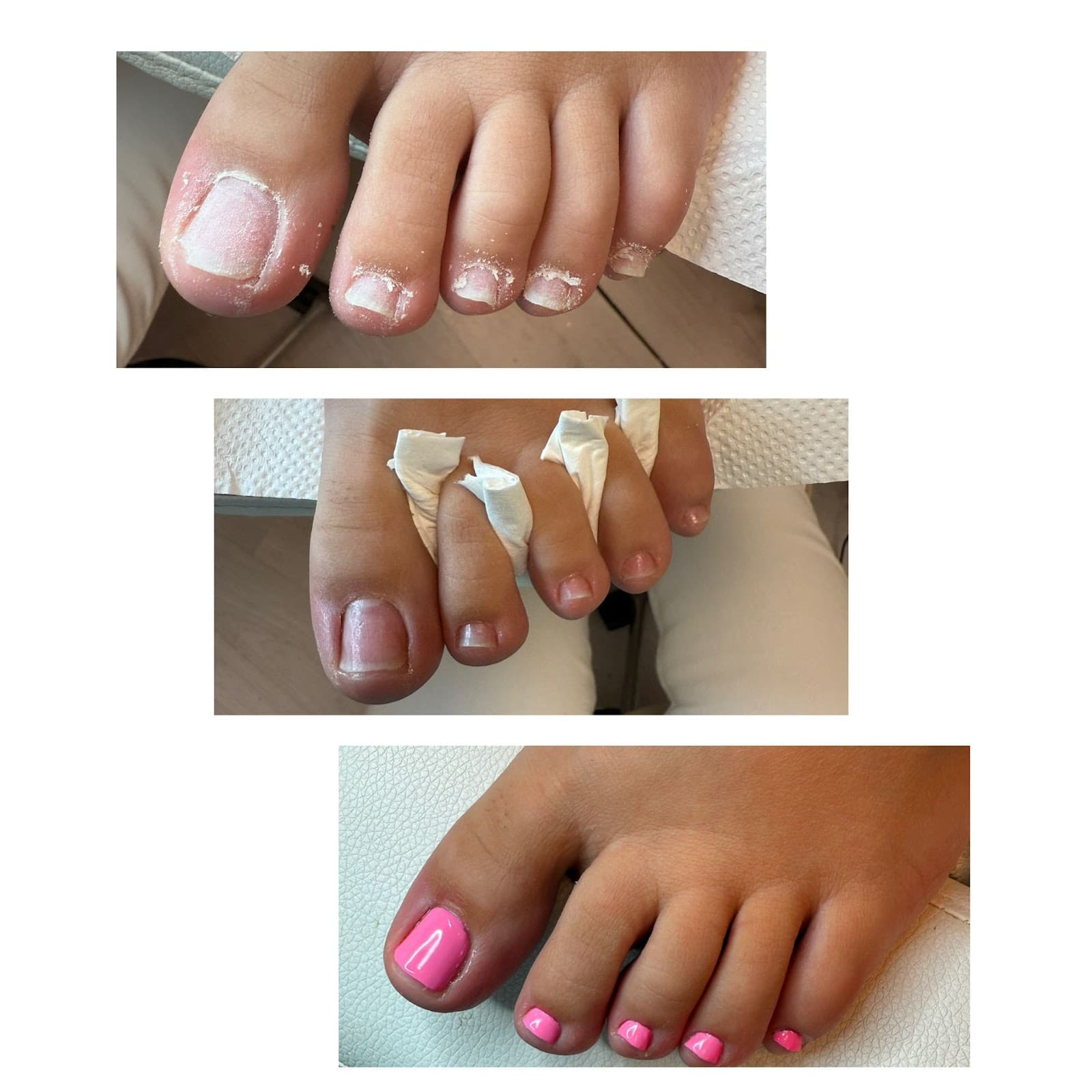 Etapele unei pedichiuri medicale complete, pas cu pas.